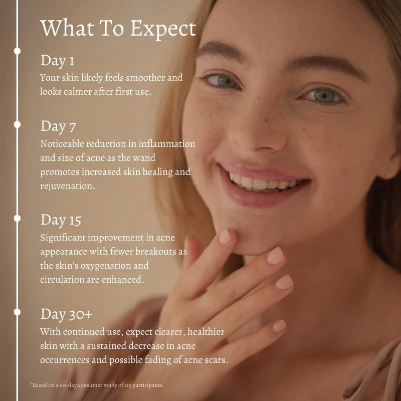 Primalderm High Frequency Therapy | Clear Acne and Prevent Future Breakouts